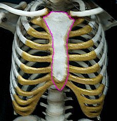 Injury Sternum